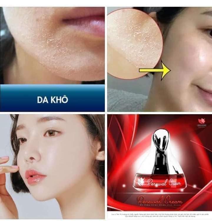 [CHÍNH HÃNG -GIÁ SỈ ] KEM ĐÊM PHA LÊ LINH HƯƠNG