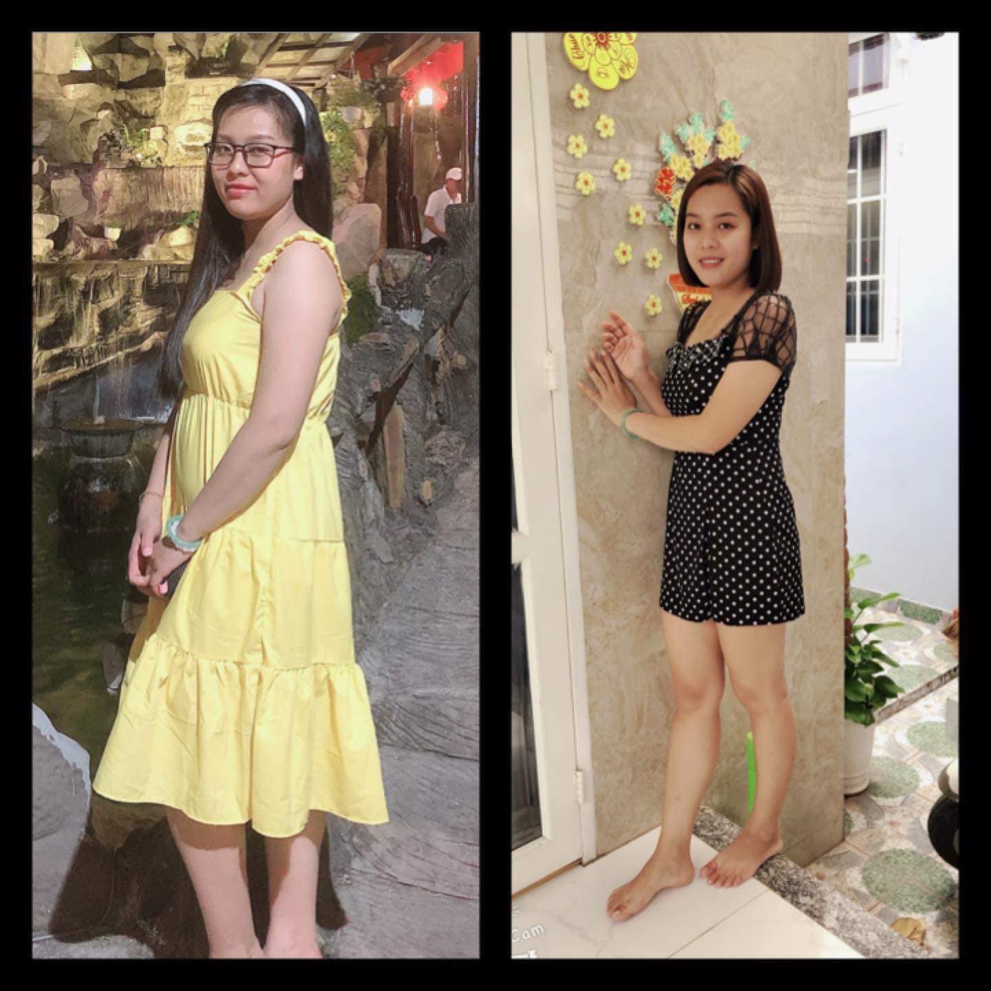 [HCM]Bộ Đôi Vichi - Vit C hủy mỡ siết eo