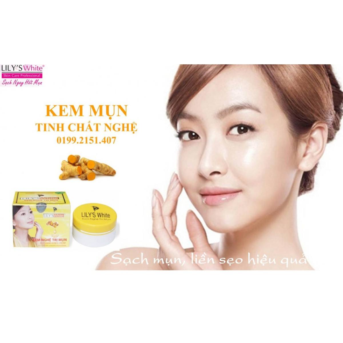 [HCM]Kem Mụn Lilys White Tinh chất nghệ