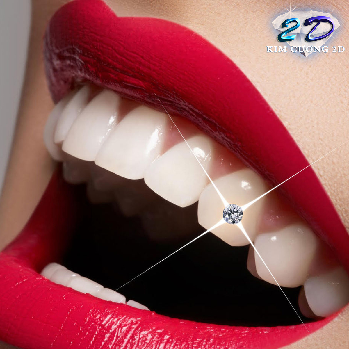 [HCM]Mua 1 tặng 1 -Đá đính răng Thụy Sĩ 3LY (loại lớn)