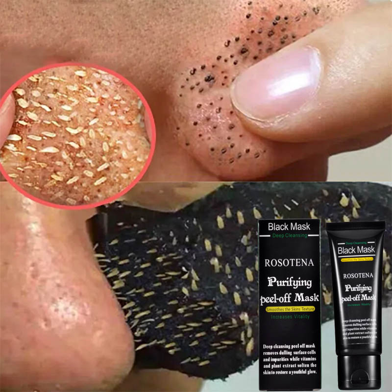 Mặt nạ lột mụn đầu đen black mask 50ml than hoạt tính hút sạch mụn cám mụn đầu đen loại bỏ bụi bẩn làm sạch sâu