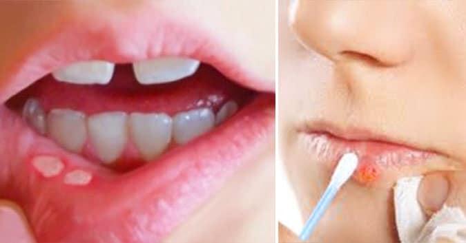Tinh Dầu Dạ Thảo Liên