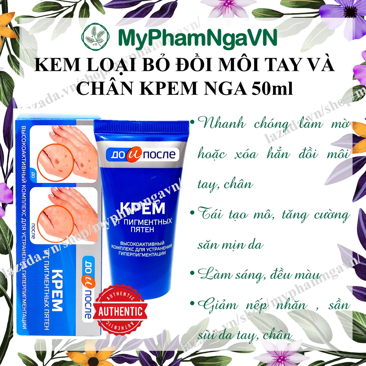 [HCM]Kem Loại Bỏ Đồi Mồi Da Tay Chân Kpem 50ml