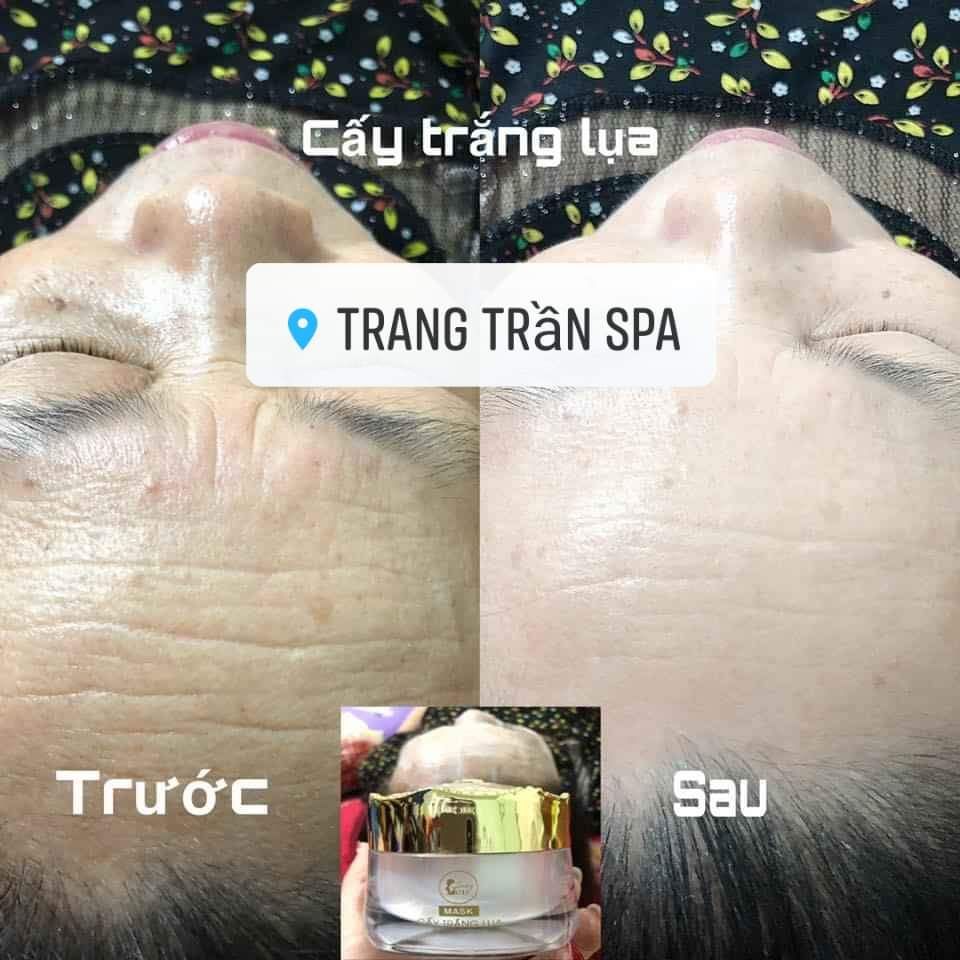 Mask cấy trắng lụa nano collagen (chính hãng)