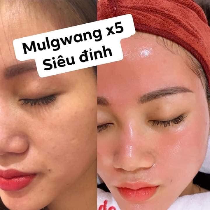 Tinh chất căng bóng Mulwang x5 Hàn Quốc