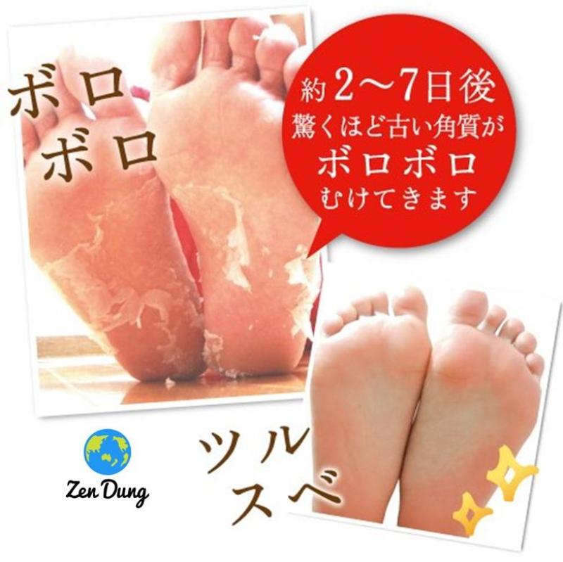 Túi ủ Baby foot Nhật Bản chữa chai chân nứt nẻ chân bán chạy nhất thế giới