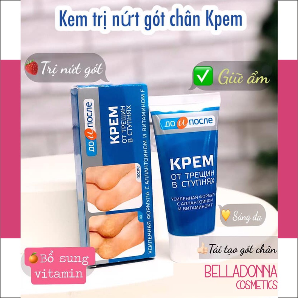 Kem dưỡng nứt nẻ gót chân KPEM 50ml