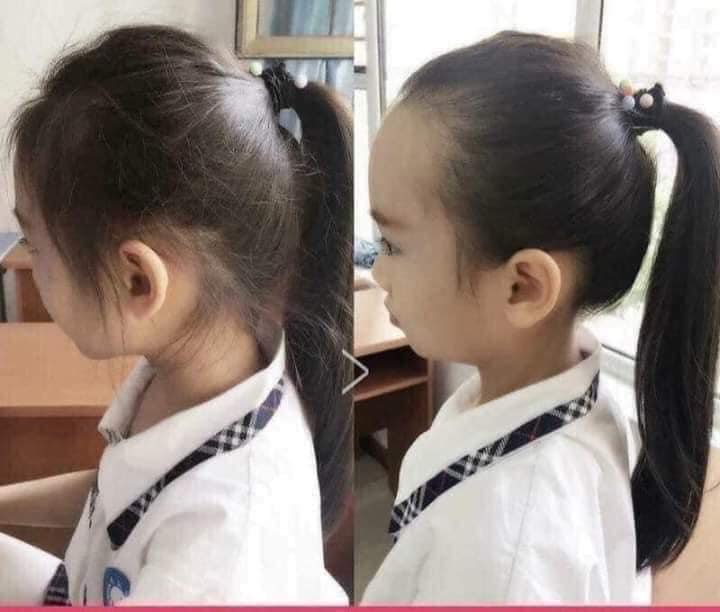 COMBO 3 CHUỐC TÓC XÙ ,DỤNG CỤ CHUỐT TÓC XÙ THẦN THÁNH