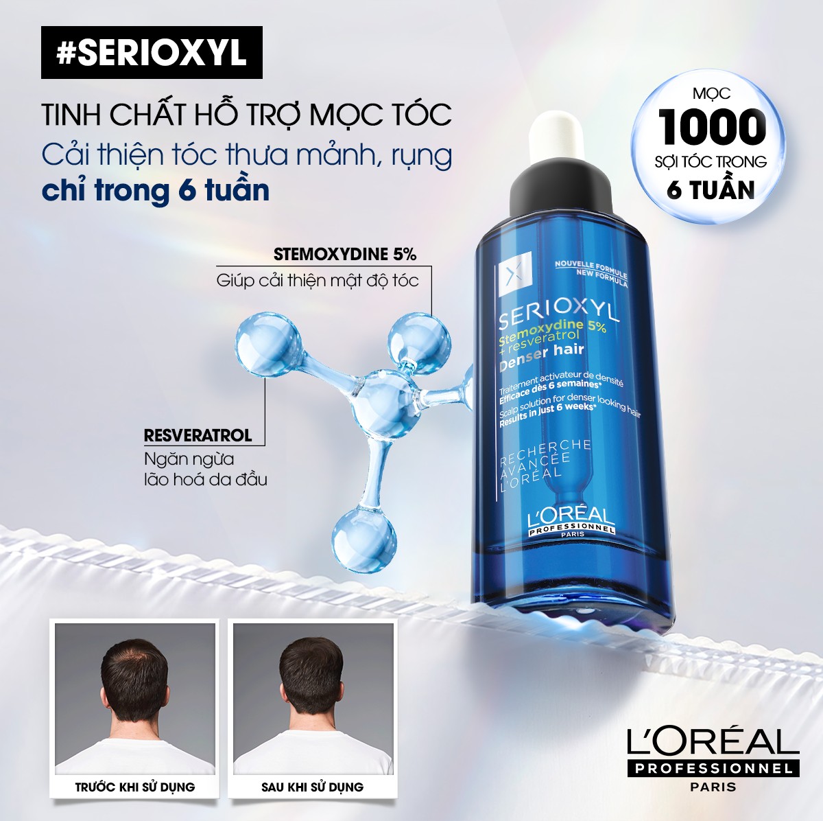 Tinh chất mọc tóc SERIOXYL 90ml