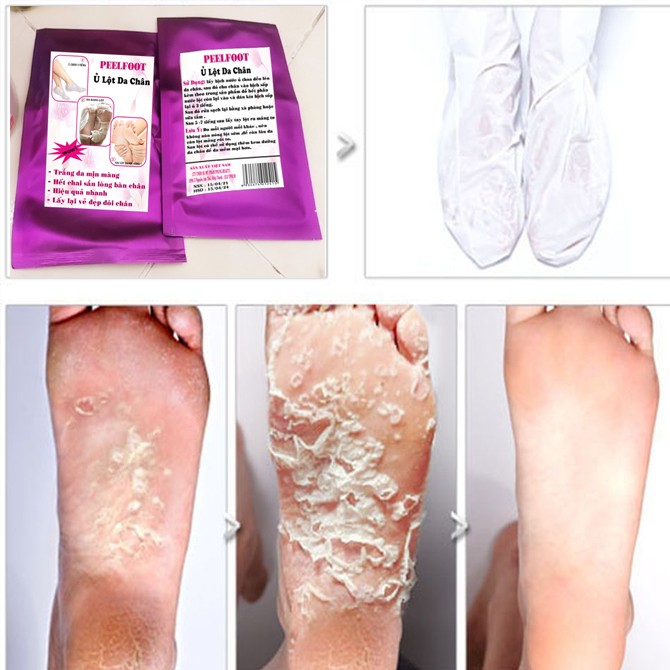 [HCM]Feelfoot Ủ Lột Da Chân Trắng Da Hết Chai Sần