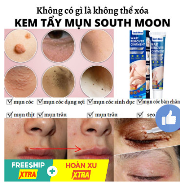 {ĐÁNH BẬT} MỤN CÓC, MỤN THỊT REMOVE EVERY WARTS