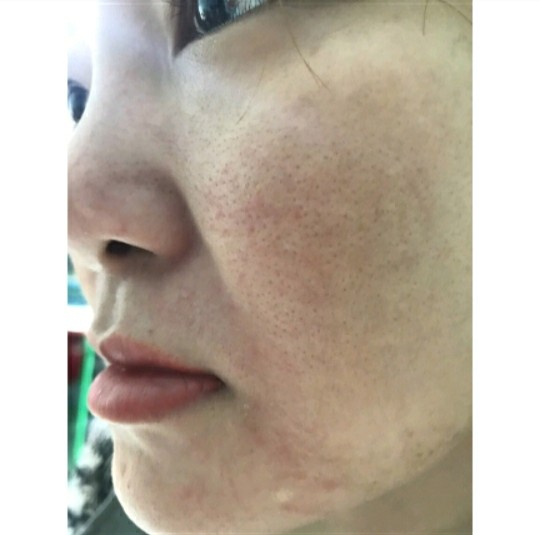 SERUM THẢO DƯỢC SẠCH NÁM MAY NEW 50ML