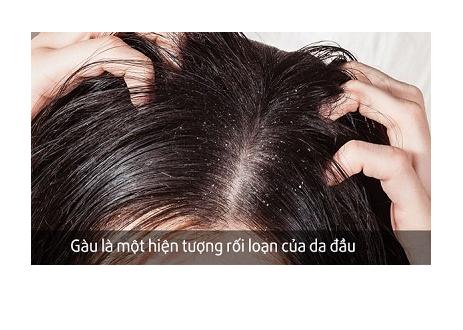 DẦU GỘI NAZOR SHAMPOO 100ML.