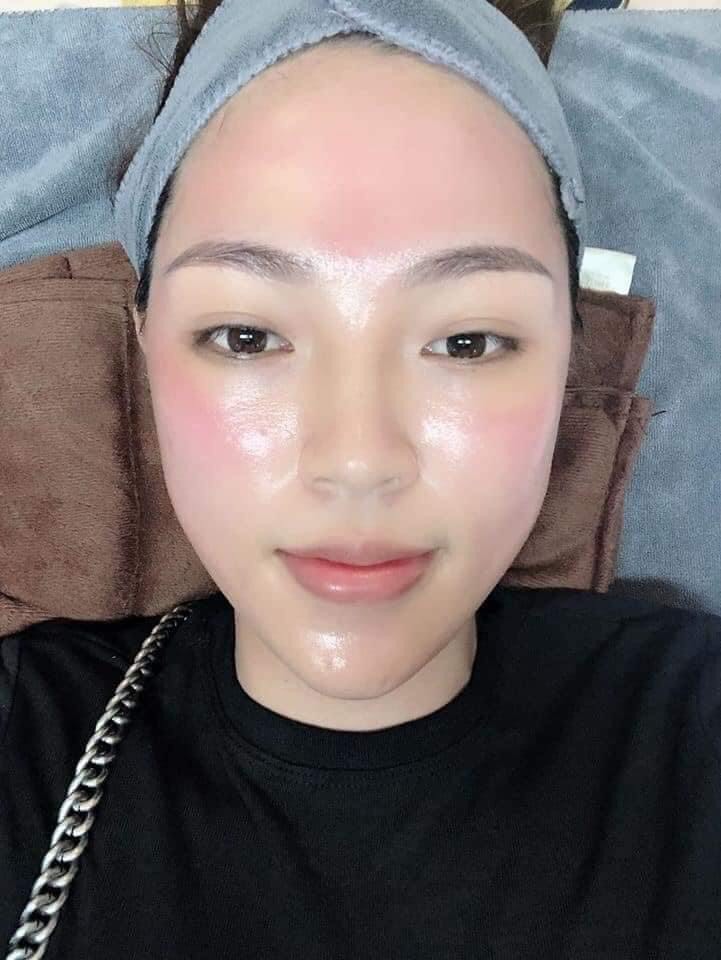 Serum căng bóng da Mulwang X5 Hàn Quốc 10ml
