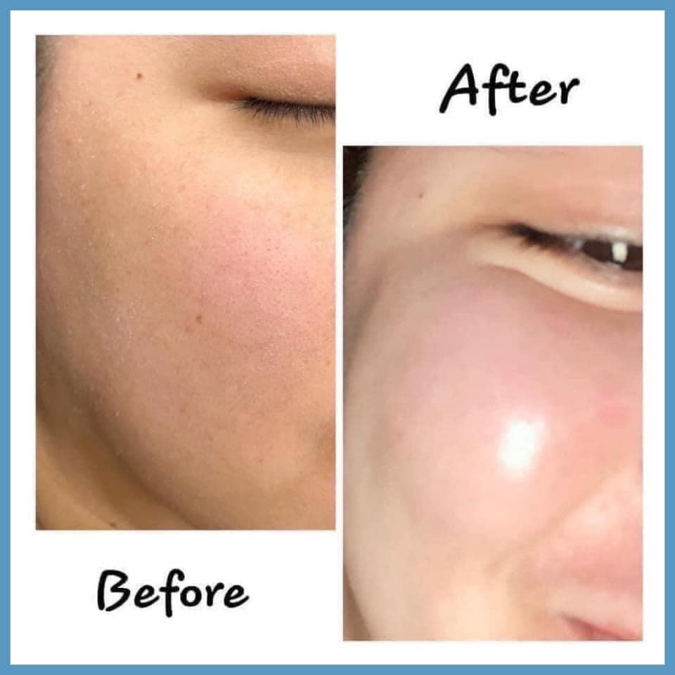 [SMAS] Serum HA Plus siêu cấp ẩm & Pro Vitamin B5 phục hồi da