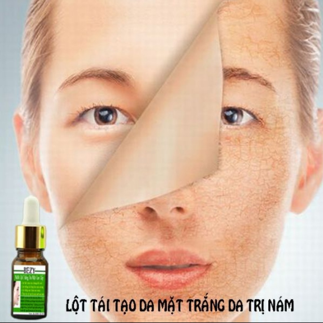 Bộ Peel Da Mặt & Kem Trắng Da Collagen