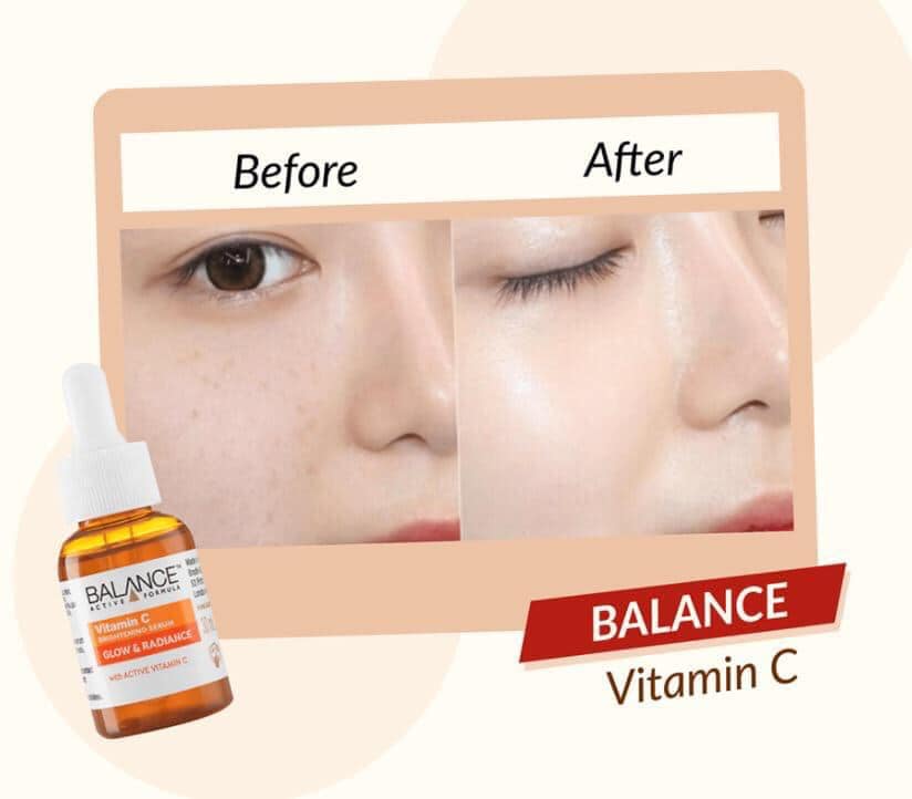 Serum BALENCE Vitamin C 30ml của ANH