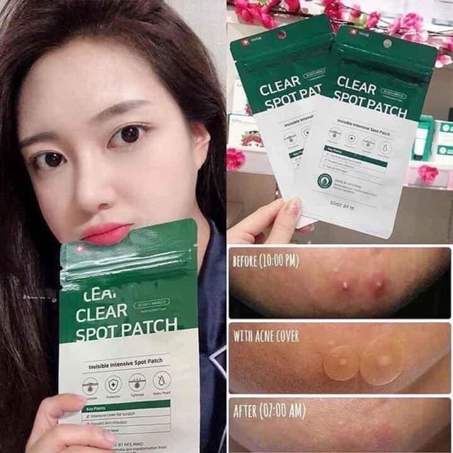Miếng dán mụn some by mi 30 days miracle clear spot patch