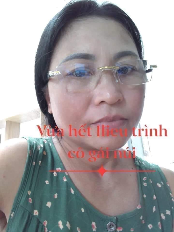 [HCM]Cỏ tr ị nám Cô Gái Núi