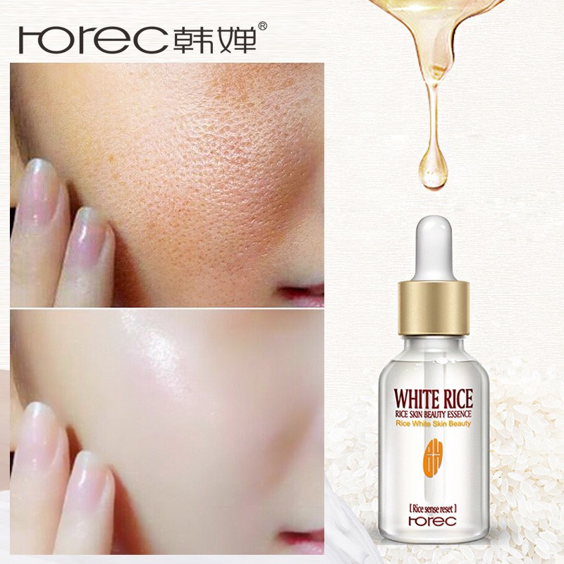 Serum Dưỡng Trắng Da Rice White Skin Beauty Của Rorec