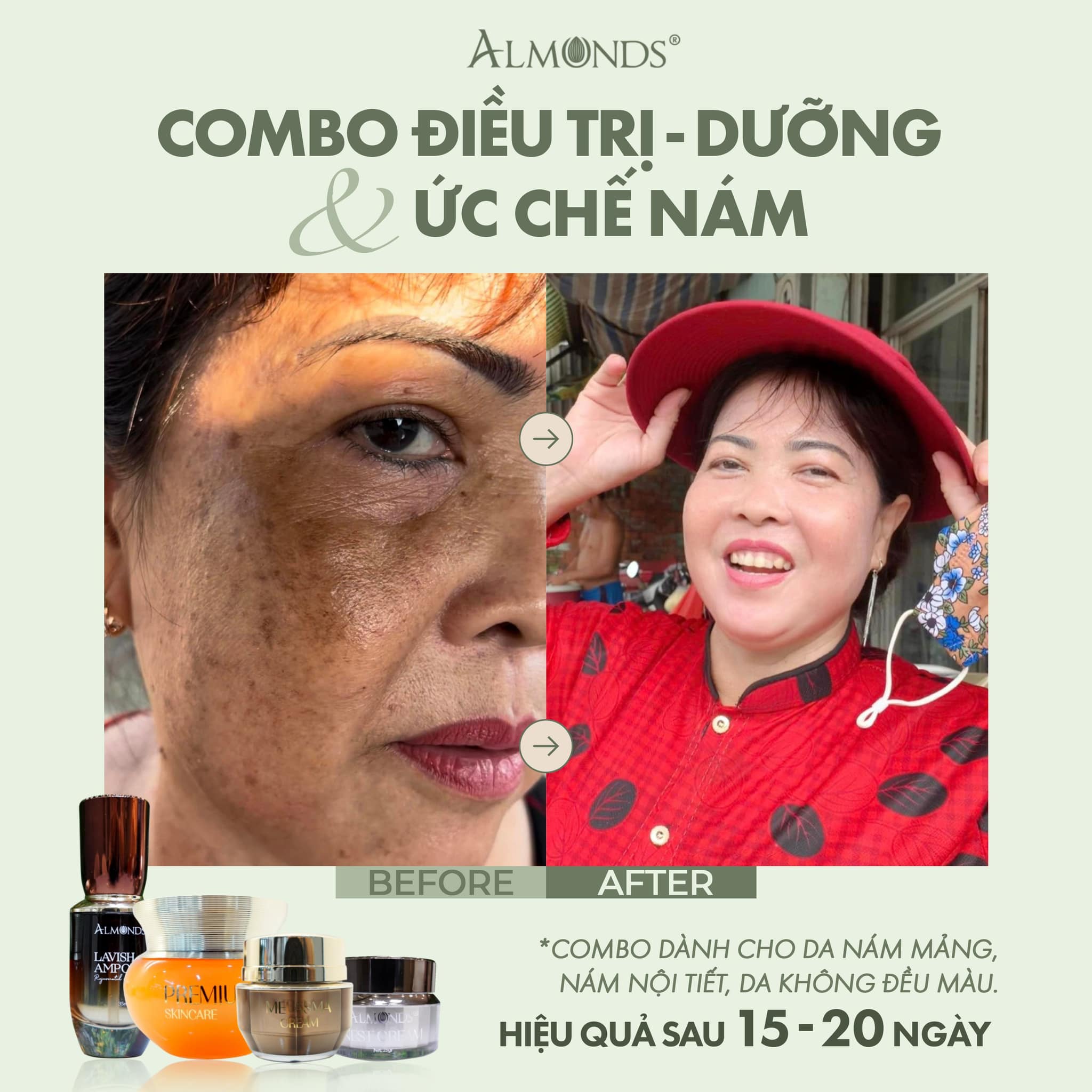 Serum Tế Bào Gốc Phục Hồi Da Almonds Lavish Ampoule