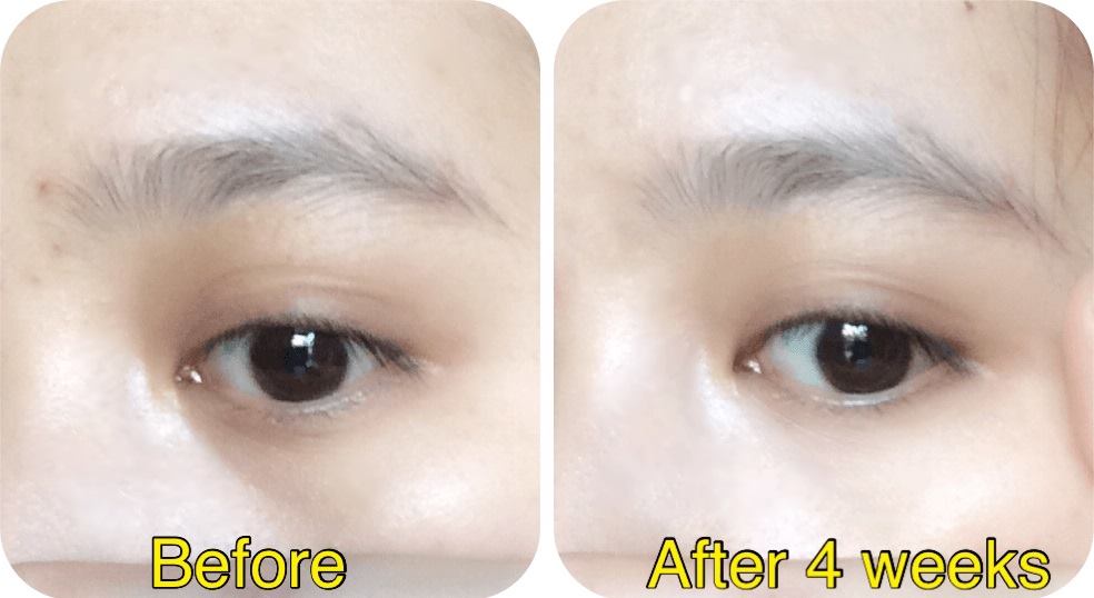 Lăn mắt Simple Kind to Eyes Revitalizing Eye Roll-On