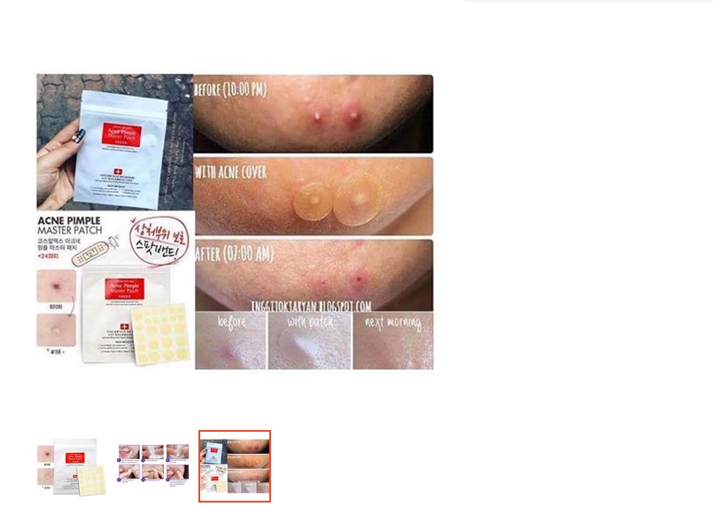 Miếng Dán Mụn COSRX Hàn Quốc