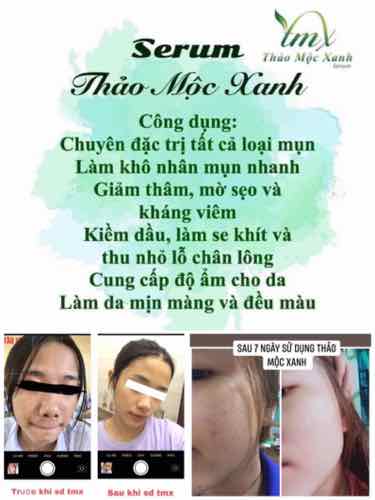 Sữa rửa mặt tạo bọt thảo mộc xanh