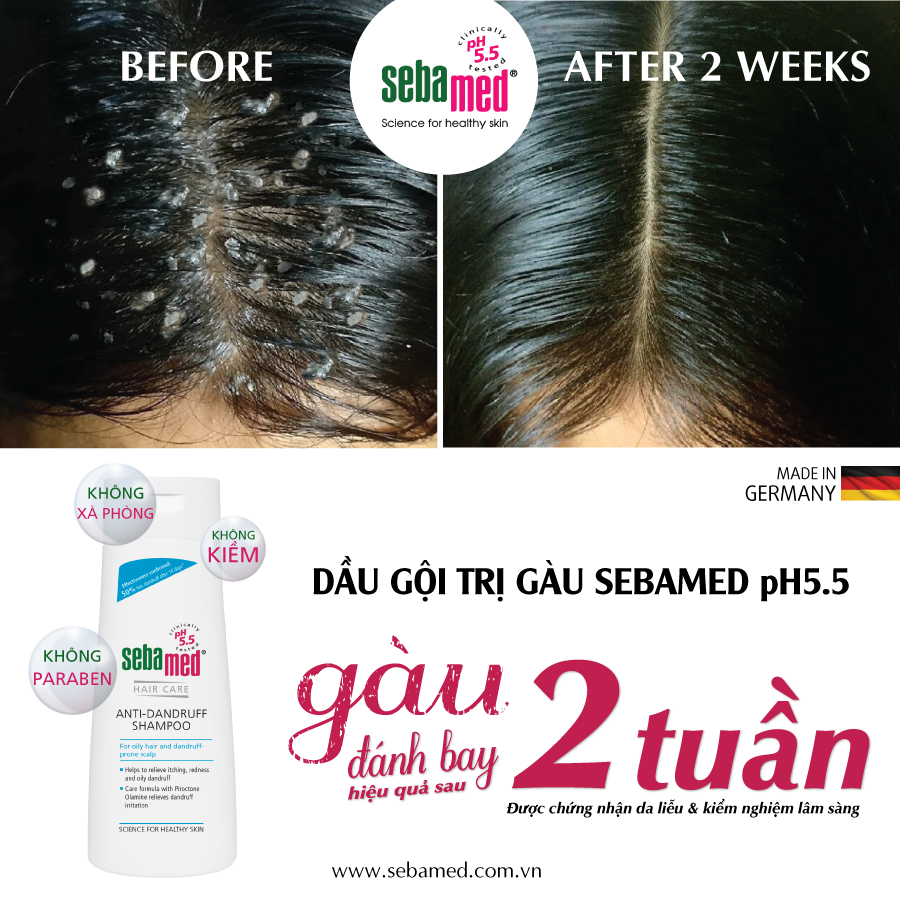 [HCM]DẦU GỘI TRỊ GÀU GIẢM NGỨA SEBAMED pH5.5