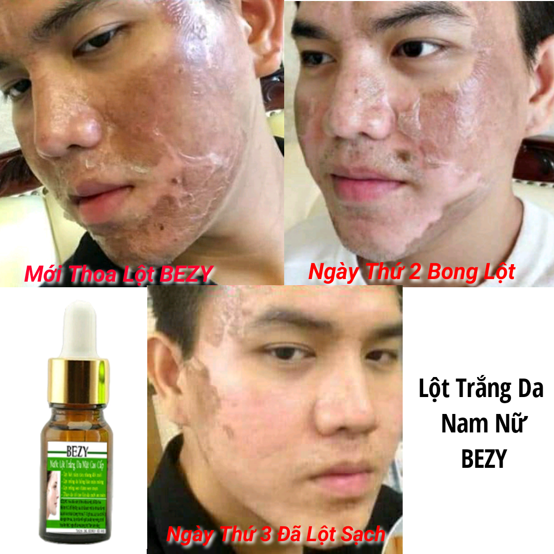 Lột Thay Da Sinh Học Trắng Da Hết Nám Sạm BEZY Thái Lan