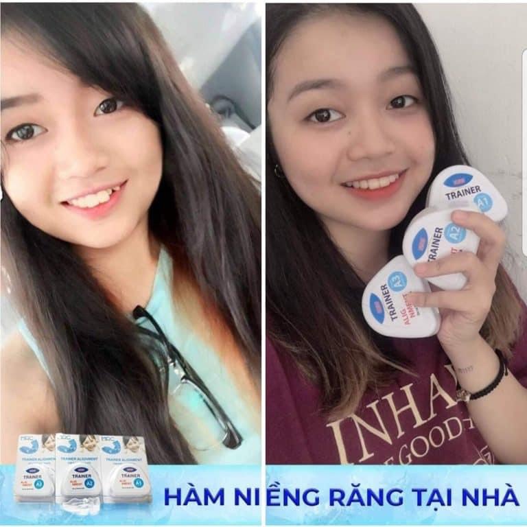 [HCM]Dụng cụ niềng răng trong suốt tại nhà Trainer COMBO [A1+A2+A3]