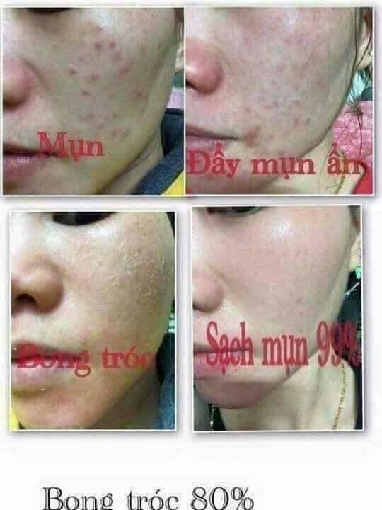 Kem KONÉ Thái Lan (Kem Ngày)