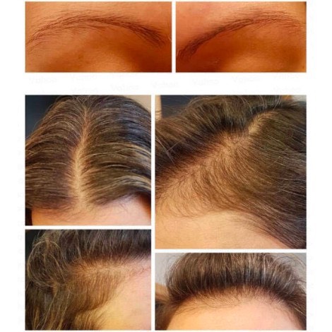 Tinh Chất Dưỡng Tóc The Ordinary Multi – Peptide Serum For Hair Density 60ML