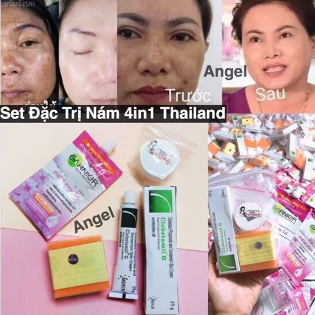 [HCM]Bộ kem loại bỏ nam hiệu quả Garnier Thái Lan bộ mỹ phẩm Gaenier 5 món Thái Lan bộ sản phẩm 5in1 Thái Lan bộ kem  dưỡng  da Thái Lan
