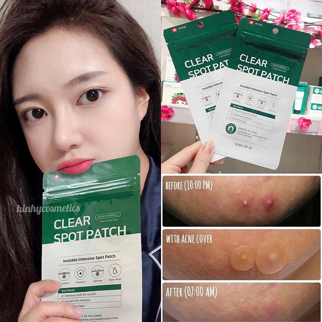 Miếng Dán Mụn Some By Mi Clear Spot Patch 18 miếng