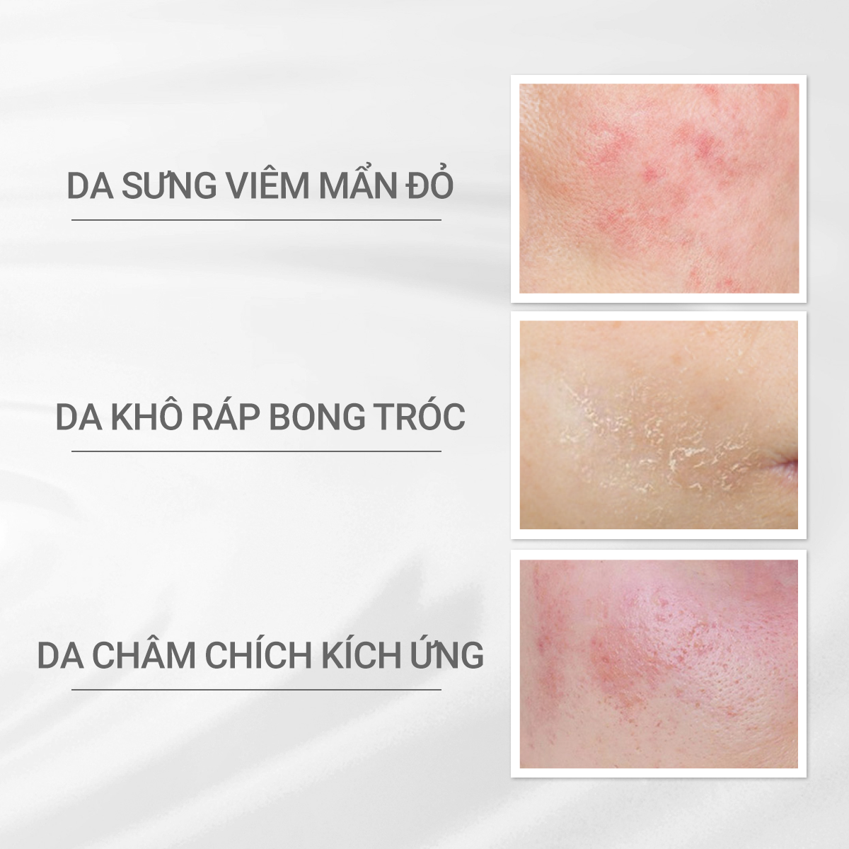 Kem dưỡng ẩm và phục hồi da d Program Skin Repair Cream 45g