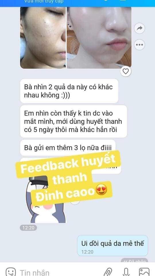 Serum trắng da TRẺ HÓA 7 DAY OLIC