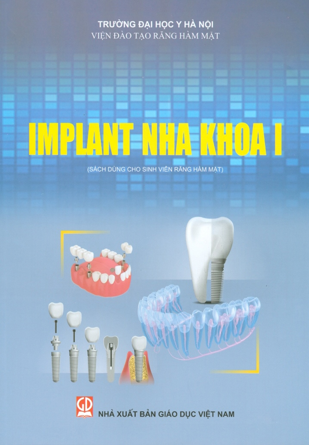 Implant Nha Khoa I (Sách Dùng Cho Sinh Viên Răng Hàm Mặt)