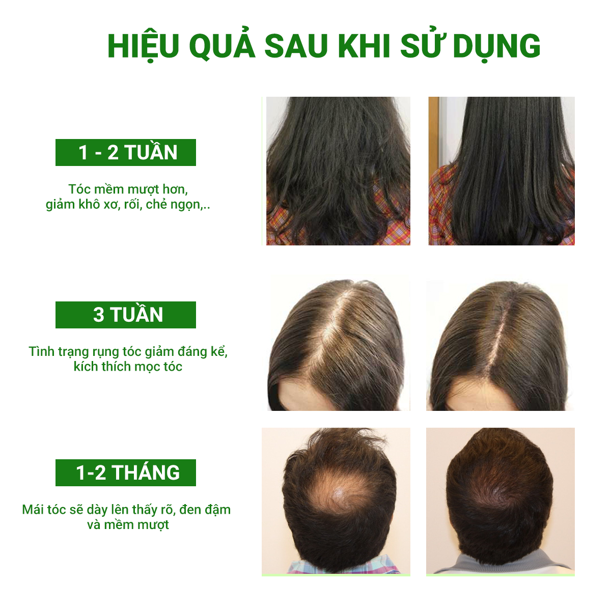 ( TẶNG MẶT NẠ) Xịt Dưỡng Tóc Pomelo Tinh Dầu Bưởi Cao Cấp - Nacha Beauty - Giải pháp cho các vấn đề về tóc hư tổn
