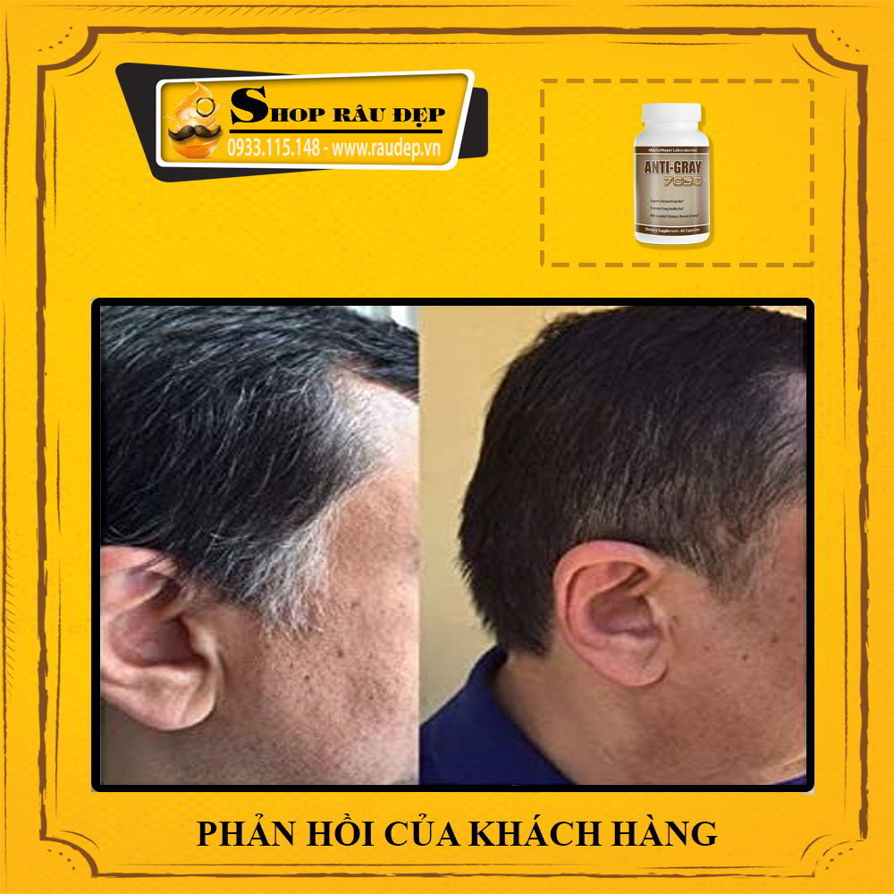 Viên Uống Chống Tóc Bạc Sớm Anti Gray 7050
