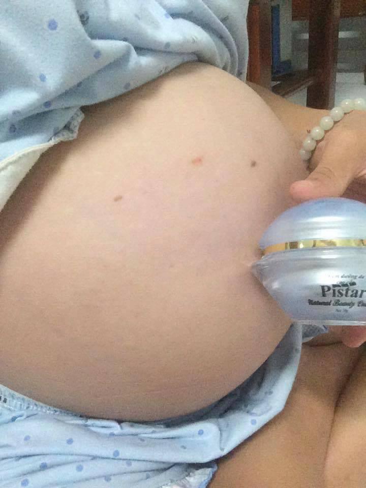 [HCM]KEM NGỪA RẠN DA CHO BÀ BẦU-PISTAR