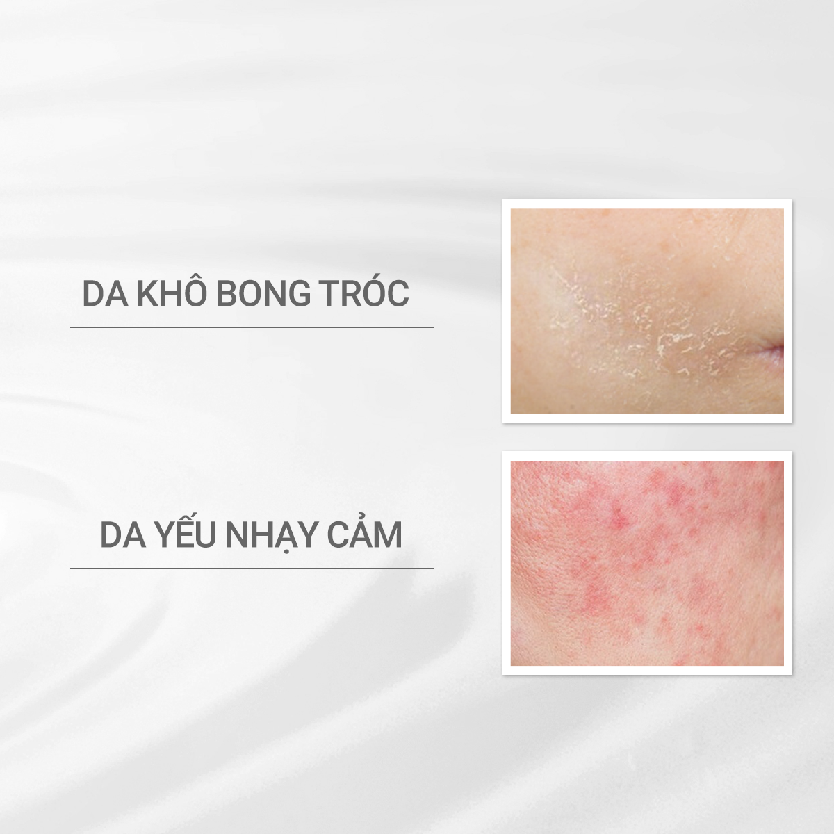 Sữa dưỡng ẩm tối ưu cho da nhạy cảm dProgram Moisturizing Care Emulsion 100ml