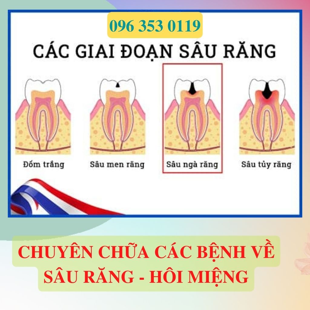 ✅[CHÍNH HÃNG] Chai Sâu Răng Người Dao Đỏ Sapa