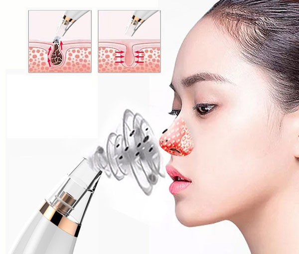 [HCM]Máy hút mụn đầu đen mini cầm tay