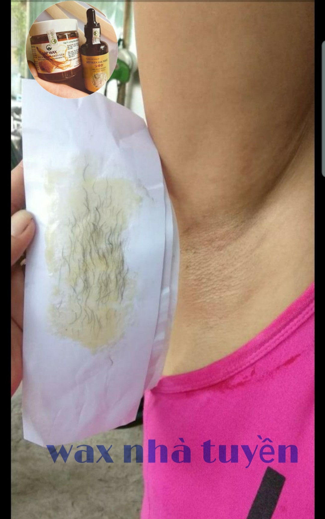 wax triệt lông