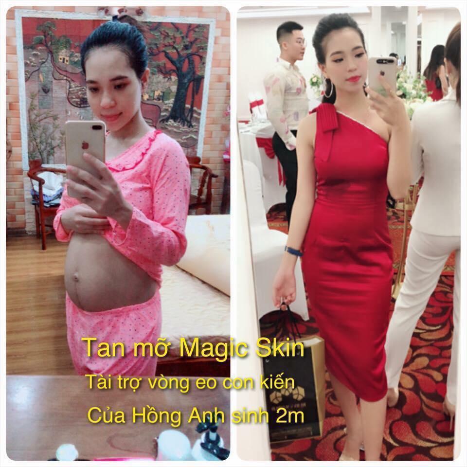 Kem Tan Mỡ Magic Skin