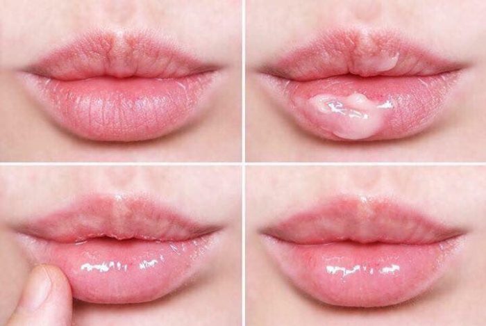 Mặt Nạ Ngủ Môi Laneige + YNM Mini 3ml