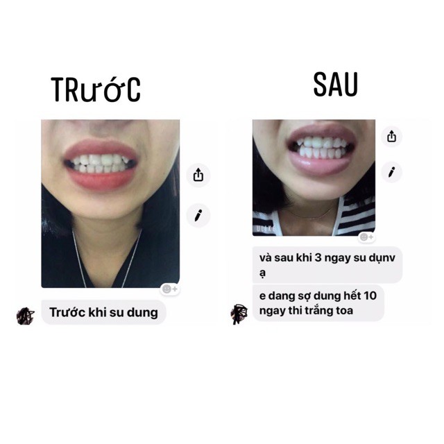 Miếng dán trắng răng Miếng dán Crest 3D White Whitestrips [Hàng Mỹ] - trắng răng Crest