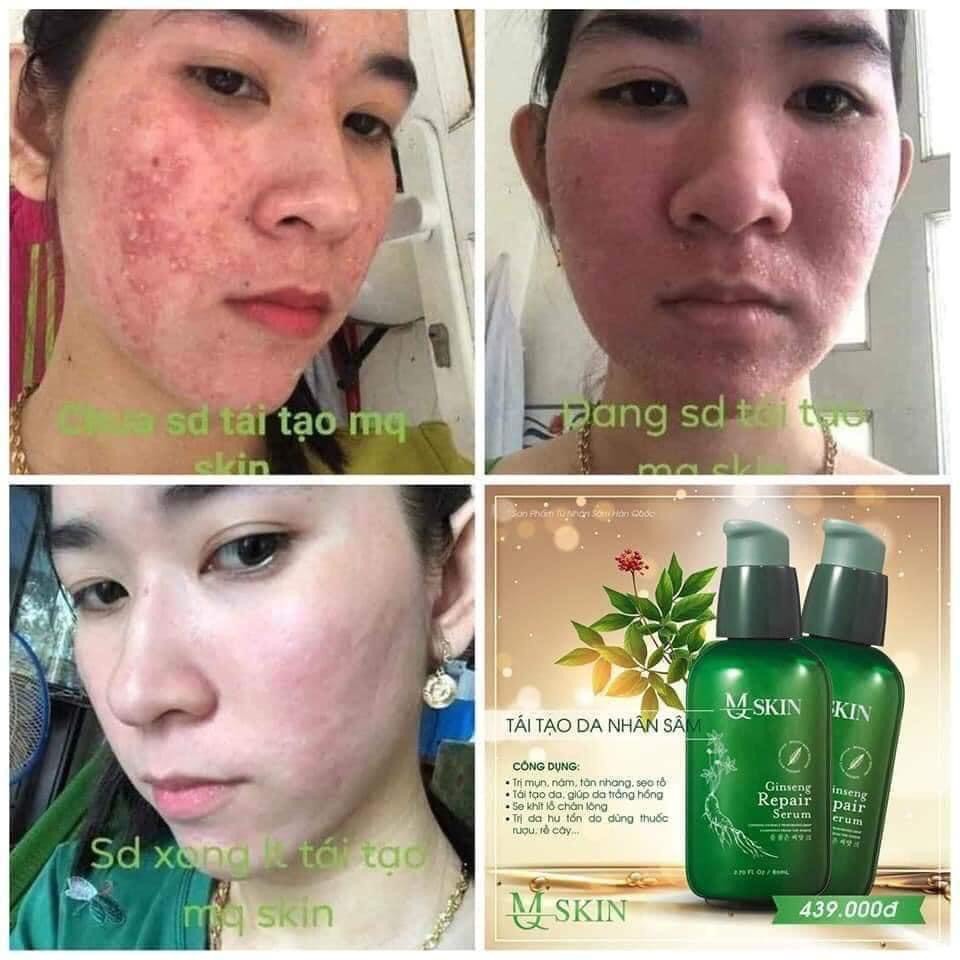 Serum Tái Tạo Da Nhân Sâm MQ SKIN 80ml