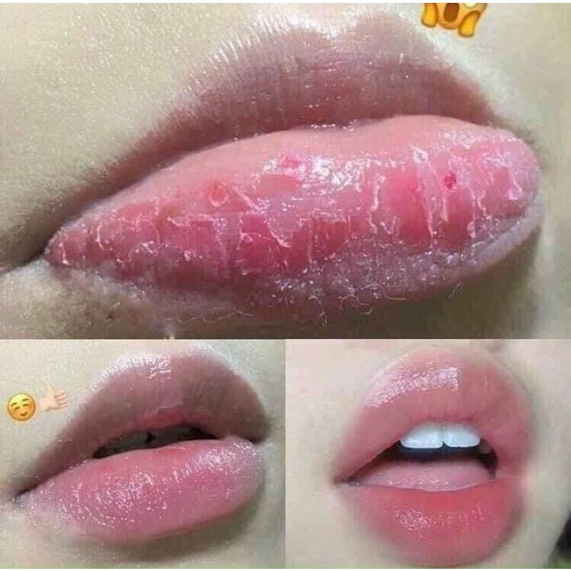 Ủ hồng môi Laneige 3gr làm mềm môi